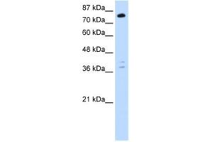 WB Suggested Anti-TSC22D2 Antibody Titration:  0. (TSC22D2 antibody  (C-Term))