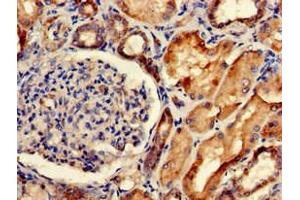 Immunohistochemistry of paraffin-embedded human kidney tissue using ABIN7175662 at dilution of 1:100