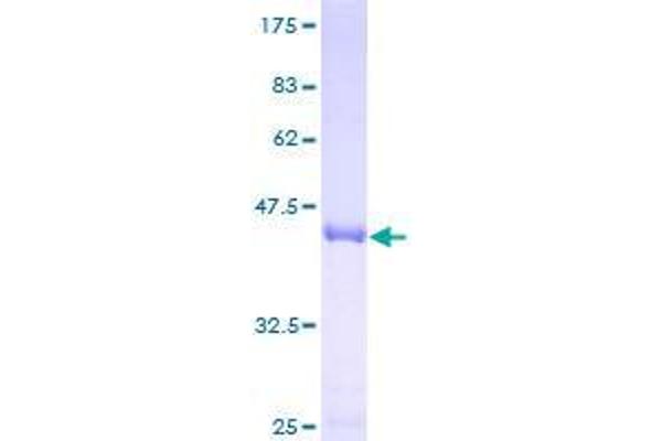 VPS25 Protein (AA 1-176) (GST tag)