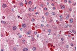 Human Liver: Formalin-Fixed, Paraffin-Embedded (FFPE) (GCLM antibody  (AA 182-231))