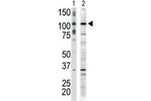 Western Blotting (WB) image for anti-Mitogen-Activated Protein Kinase Kinase Kinase 9 (MAP3K9) antibody (ABIN3003574) (MAP3K9 antibody)