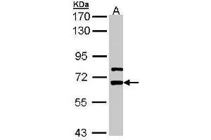 WB Image Sample (30 ug of whole cell lysate) A: A431 , 7. (LGI1 antibody)