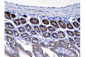 Immunohistochemistry (IHC) image for anti-WAP Four-Disulfide Core Domain 2 (WFDC2) (AA 31-168) antibody (ABIN5519074)