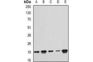 Western blot analysis of PTRH2 expression in MCF7 (A), A549 (B), mouse liver (C), mouse spleen (D), rat brain (E) whole cell lysates.