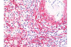 Anti-COL6A2 / Collagen VI antibody IHC staining of human spleen. (COL6A2 antibody  (AA 1-425))