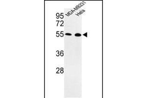 Western blot analysis of EGLN2 Antibody (Center) (ABIN652648 and ABIN2842435) in MDA-M, Hela cell line lysates (35 μg/lane). (PHD1 antibody  (AA 194-221))