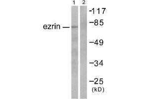 Western Blotting (WB) image for anti-Ezrin (EZR) (C-Term) antibody (ABIN1848533) (Ezrin antibody  (C-Term))