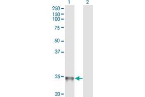 Western Blotting (WB) image for anti-RAB1B, Member RAS Oncogene Family (RAB1B) (AA 91-202) antibody (ABIN599595) (RAB1B antibody  (AA 91-202))