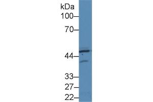 Western blot analysis of Human HeLa cell lysate, using Rat PKR Antibody (2 µg/ml) and HRP-conjugated Goat Anti-Rabbit antibody ( (EIF2AK2 antibody  (AA 279-506))