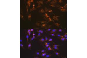 Immunofluorescence analysis of C6 cells using GLUT2/SLC2 Rabbit mAb (ABIN7270414) at dilution of 1:100 (40x lens). (SLC2A2 antibody)