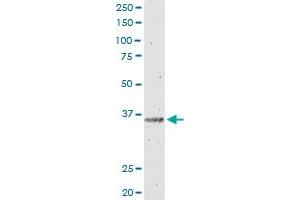 IL12B monoclonal antibody (M01), clone 2H6. (IL12B antibody  (AA 229-328))