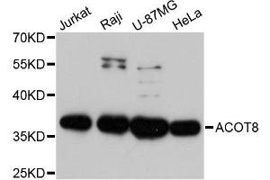 Western blot analysis of extracts of various cell lines, using ACOT8 antibody. (ACOT8 antibody  (AA 1-220))