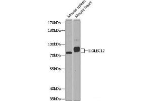 Western blot analysis of extracts of various cell lines using SIGLEC12 Polyclonal Antibody at dilution of 1:1000. (SIGLEC12 antibody)