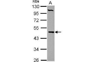 WB Image Sample (30 ug of whole cell lysate) A: HepG2 10% SDS PAGE antibody diluted at 1:1000 (PCYT2 antibody)