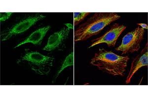 ICC/IF Image Citrate synthetase antibody [N2C3] detects Citrate synthetase protein at mitochondria by immunofluorescent analysis.