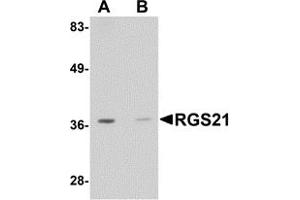 Western Blotting (WB) image for anti-Regulator of G-Protein Signaling 21 (RGS21) (Middle Region) antibody (ABIN1031060)