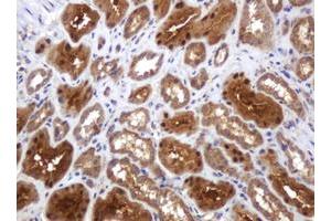 Image no. 2 for anti-TBC1 Domain Family, Member 13 (TBC1D13) antibody (ABIN1501310) (TBC1D13 antibody)
