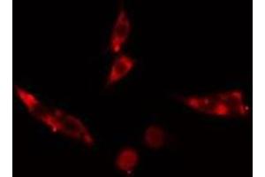 ABIN6275569 staining Hela cells by IF/ICC. (SH3G2 antibody  (Internal Region))