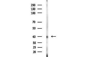 anti-Methyltransferase Like 5 (METTL5) (Internal Region) antibody