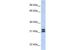 PYCR2 antibody used at 1 ug/ml to detect target protein. (PYCR2 antibody  (Middle Region))