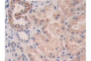 DAB staining on IHC-P; Samples: Human Kidney Tissue (KIR2DL3 antibody  (AA 22-342))