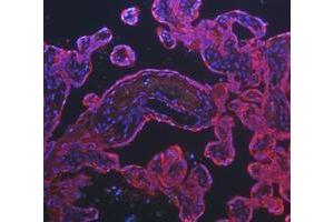 IF analysis of Cytokeratin 8/KRT8 using anti-Cytokeratin 8/KRT8 antibody (ABIN5518853). (KRT8 antibody  (AA 107-325))
