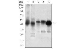 Western blot analysis using PDK2 mouse mAb against Jurkat (1), C6 (2), Cos7 (3), K562 (4), A431 (5) cell lysate.