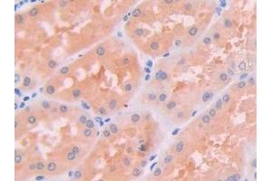 Detection of JAK2 in Human Kidney Tissue using Polyclonal Antibody to Janus Kinase 2 (JAK2) (JAK2 antibody  (AA 508-800))