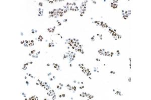 Immunocytochemistry (ICC) image for anti-Poly (ADP-Ribose) Polymerase 1 (PARP1) (AA 750-800) antibody (ABIN7449531) (Recombinant PARP1 antibody  (AA 750-800))