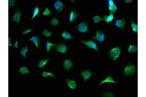 Immunofluorescence staining of A549 cells with ABIN7154202 at 1:100, counter-stained with DAPI. (AGL antibody  (AA 1217-1378))