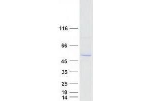 Validation with Western Blot (CYP2A7 Protein (Transcript Variant 2) (Myc-DYKDDDDK Tag))