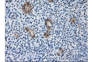 Immunohistochemical staining of paraffin-embedded Kidney tissue using anti-SORDmouse monoclonal antibody. (SORD antibody)