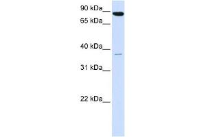 Synaptophysin antibody used at 1 ug/ml to detect target protein. (Synaptophysin antibody  (N-Term))