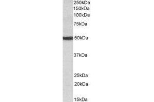 Western Blotting (WB) image for anti-Cytochrome P450, Family 24, Subfamily A, Polypeptide 1 (CYP24A1) (Internal Region) antibody (ABIN2464768) (CYP24A1 antibody  (Internal Region))
