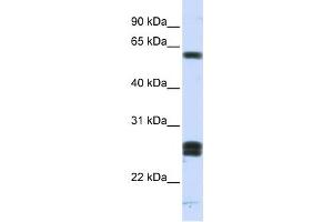 Western Blotting (WB) image for anti-Hyaluronan Binding Protein 2 (HABP2) antibody (ABIN2459800) (HABP2 antibody)