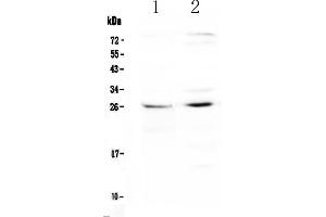 Western blot analysis of SLC31A1/CTR1 using anti-SLC31A1/CTR1 antibody .