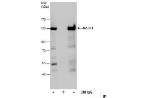 IP Image Immunoprecipitation of RAD21 protein from Jurkat whole cell extracts using 5 μg of RAD21 antibody, Western blot analysis was performed using RAD21 antibody, EasyBlot anti-Rabbit IgG  was used as a secondary reagent. (RAD21 antibody  (Center))