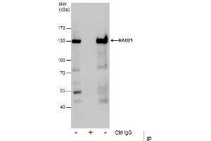 IP Image Immunoprecipitation of RAD21 protein from Jurkat whole cell extracts using 5 μg of RAD21 antibody, Western blot analysis was performed using RAD21 antibody, EasyBlot anti-Rabbit IgG  was used as a secondary reagent.