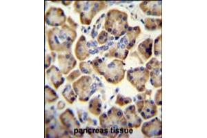 RADIL antibody immunohistochemistry analysis in formalin fixed and paraffin embedded human pancreas tissue followed by peroxidase conjugation of the secondary antibody and DAB staining. (Radil antibody  (C-Term))