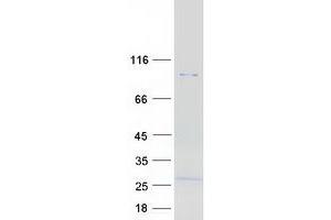Western Blotting (WB) image for Rhomboid 5 Homolog 1 (RHBDF1) protein (Myc-DYKDDDDK Tag) (ABIN2730839)