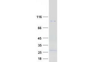 Validation with Western Blot (RHBDF1 Protein (Myc-DYKDDDDK Tag))