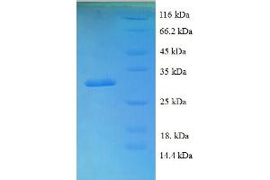 SDS-PAGE (SDS) image for Bone Morphogenetic Protein 4 (BMP4) (AA 293-408) protein (His-SUMO Tag) (ABIN5709145) (BMP4 Protein (AA 293-408) (His-SUMO Tag))