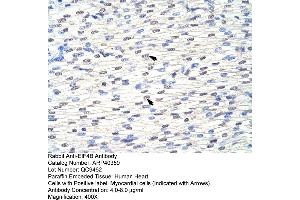 Rabbit Anti-EIF4B Antibody  Paraffin Embedded Tissue: Human Heart Cellular Data: Myocardial cells Antibody Concentration: 4. (EIF4B antibody  (C-Term))