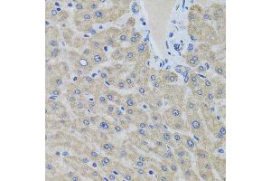 Immunohistochemistry of paraffin-embedded human liver using EIF2S3 antibody at dilution of 1:100 (x40 lens). (EIF2S3 antibody)
