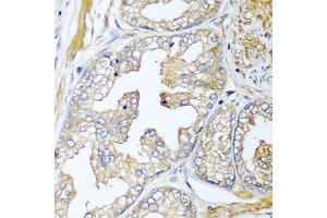 Immunohistochemistry of paraffin-embedded human prostate using CFD antibody at dilution of 1:100 (40x lens). (Adipsin antibody)