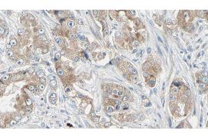 ABIN6279041 at 1/100 staining Human prostate tissue by IHC-P. (RPL18A antibody  (Internal Region))