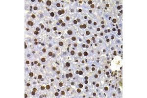 Immunohistochemistry of paraffin-embedded mouse liver using HIRIP3 antibody (ABIN5974221) at dilution of 1/100 (40x lens). (HIRIP3 antibody)