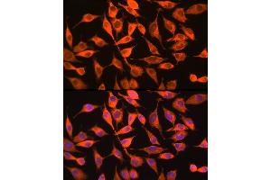 Immunofluorescence analysis of L929 cells using PITPNA Rabbit pAb (ABIN6132492, ABIN6145687, ABIN6145688 and ABIN6216795) at dilution of 1:100 (40x lens). (PITPNA antibody  (AA 211-270))