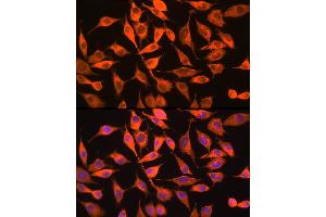 Immunofluorescence analysis of L929 cells using PITPNA Rabbit pAb (ABIN6132492, ABIN6145687, ABIN6145688 and ABIN6216795) at dilution of 1:100 (40x lens). (PITPNA antibody  (AA 211-270))