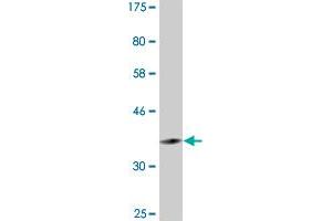 Western Blot detection against Immunogen (36. (PER3 antibody  (AA 1105-1201))